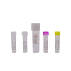 Alat Skrining Infeksi Menular Seksual (IMS) PR2026-ST02 (Metode PCR Fluoresensi)